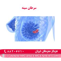 سرطان-سینه (2) سرطان سینه 2