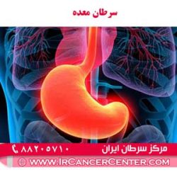 سرطان معده 1 سرطان معده 1