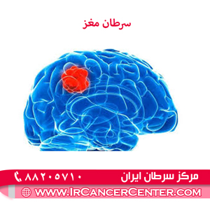 سرطان مغز