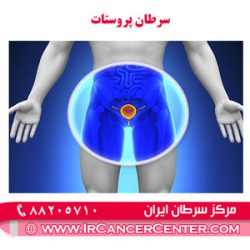 سرطان-پروستات 2 سرطان پروستات 2