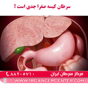 عکس سرطان کیسه صفرا